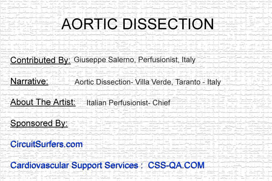 Aortic Dissection