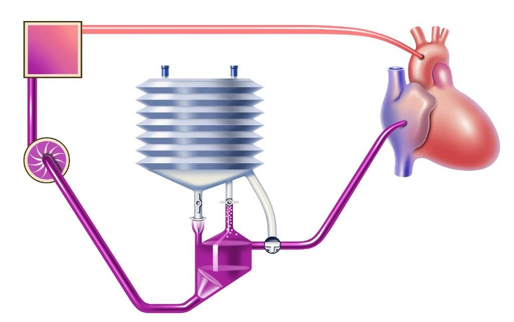 Total Perf System|4|2|3|1