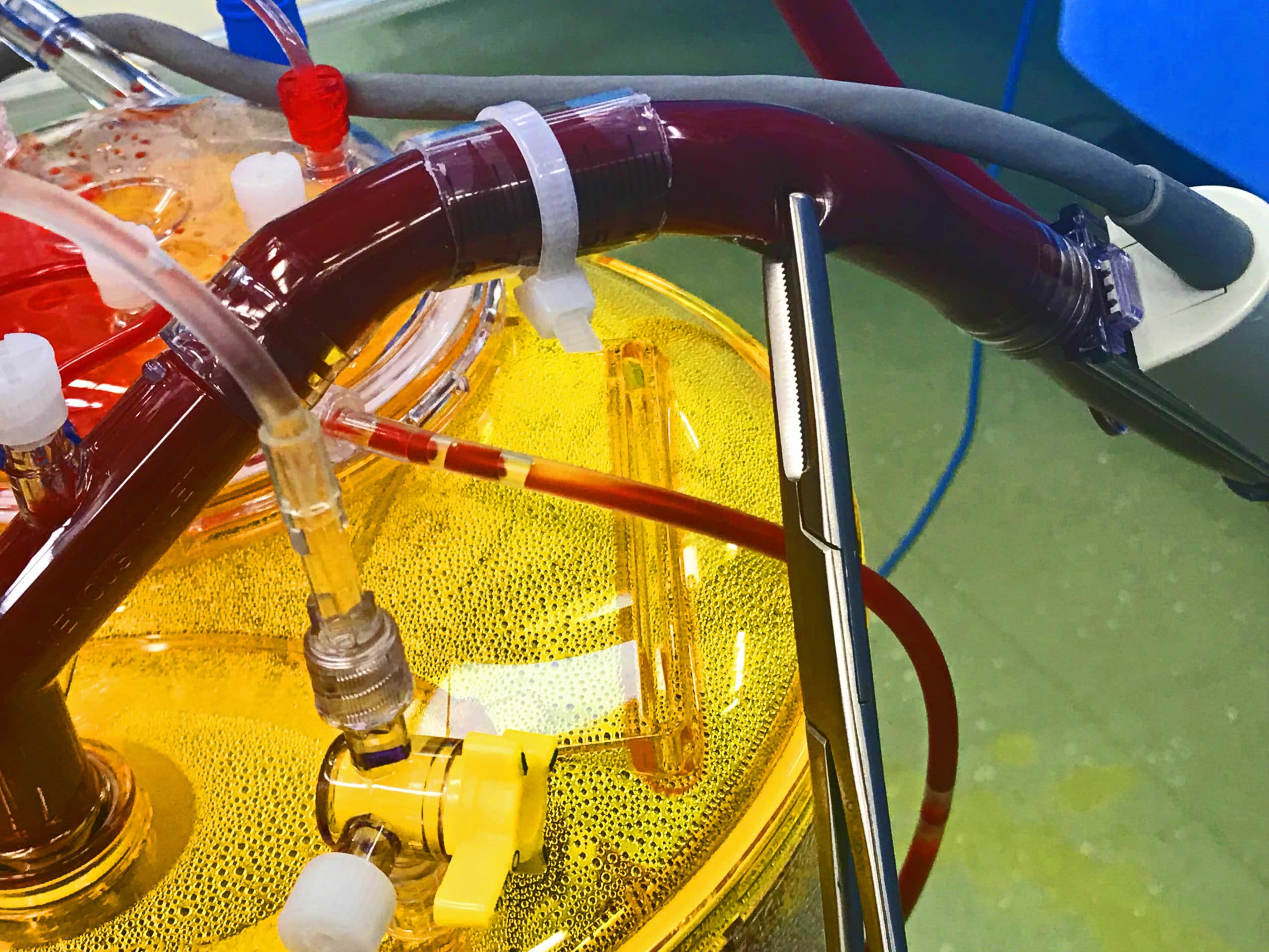 What Drives Tissue Perfusion