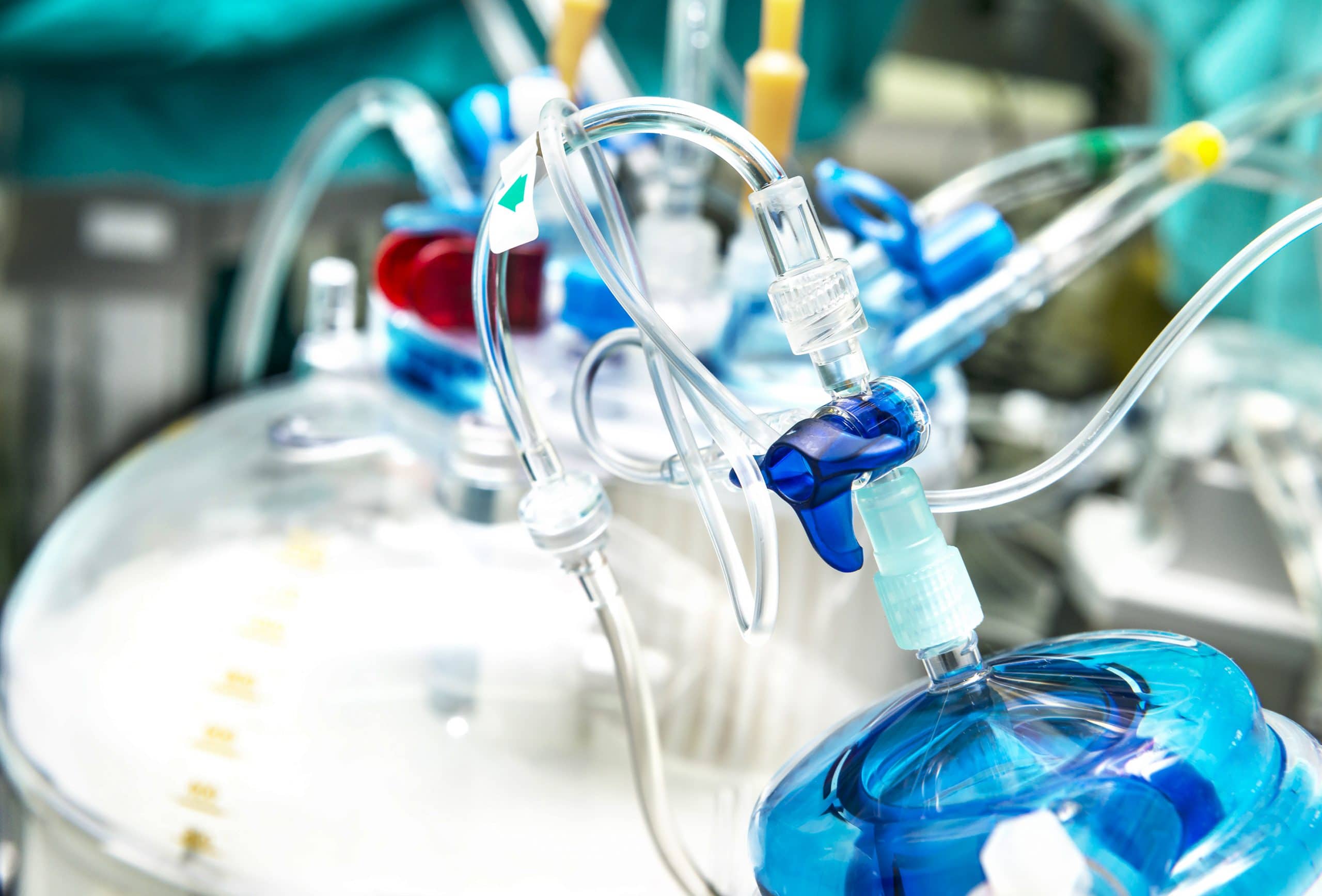 What Is Perfusion Rate