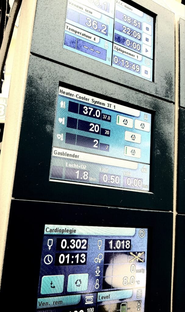 perfusion timers